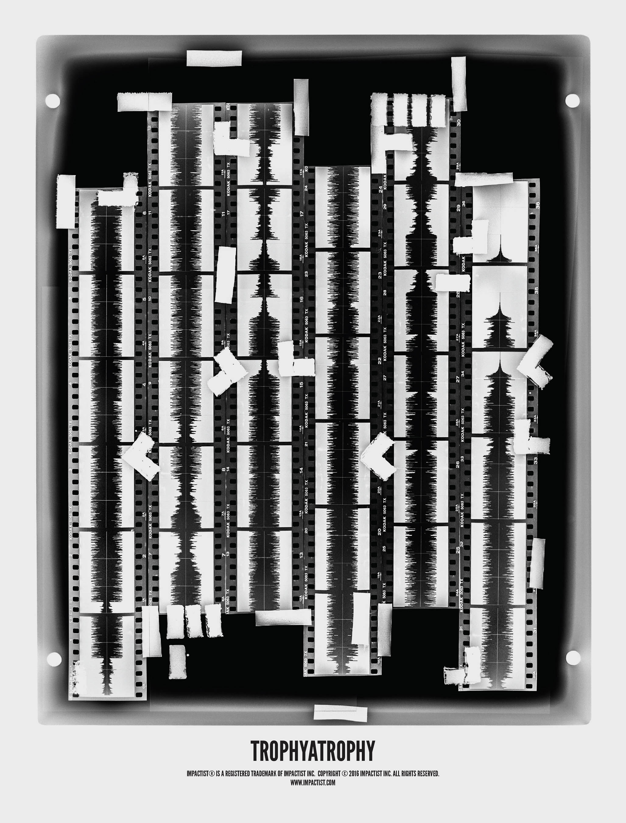 Impactist Trophyatrophy Image 16
